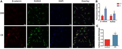 Ginsenoside Compound K Enhances Fracture Healing via Promoting Osteogenesis and Angiogenesis